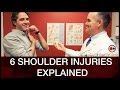 Shoulder Injuries and Treatments Quiz