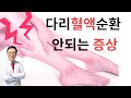 겪어보지 않고는 그 고충을 짐작못하는 다리에 혈액 순환이 안될때 나타나는 증상들  symptom of poor blood supply of leg