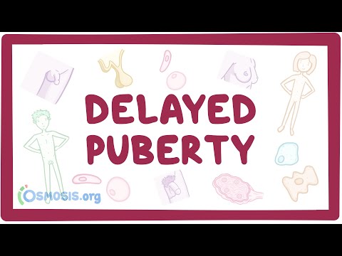 Delayed puberty - causes, symptoms, diagnosis, treatment, pathology