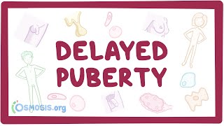 Delayed puberty - causes, symptoms, diagnosis, treatment, pathology