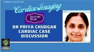 CARDIAC IMAGING DISCUSSION | DR PRIYA CHUDGAR | JOURNAL CLUB #cardiacmri