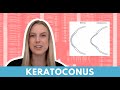 Top Ways To Diagnose And Treat Keratoconus With Laura