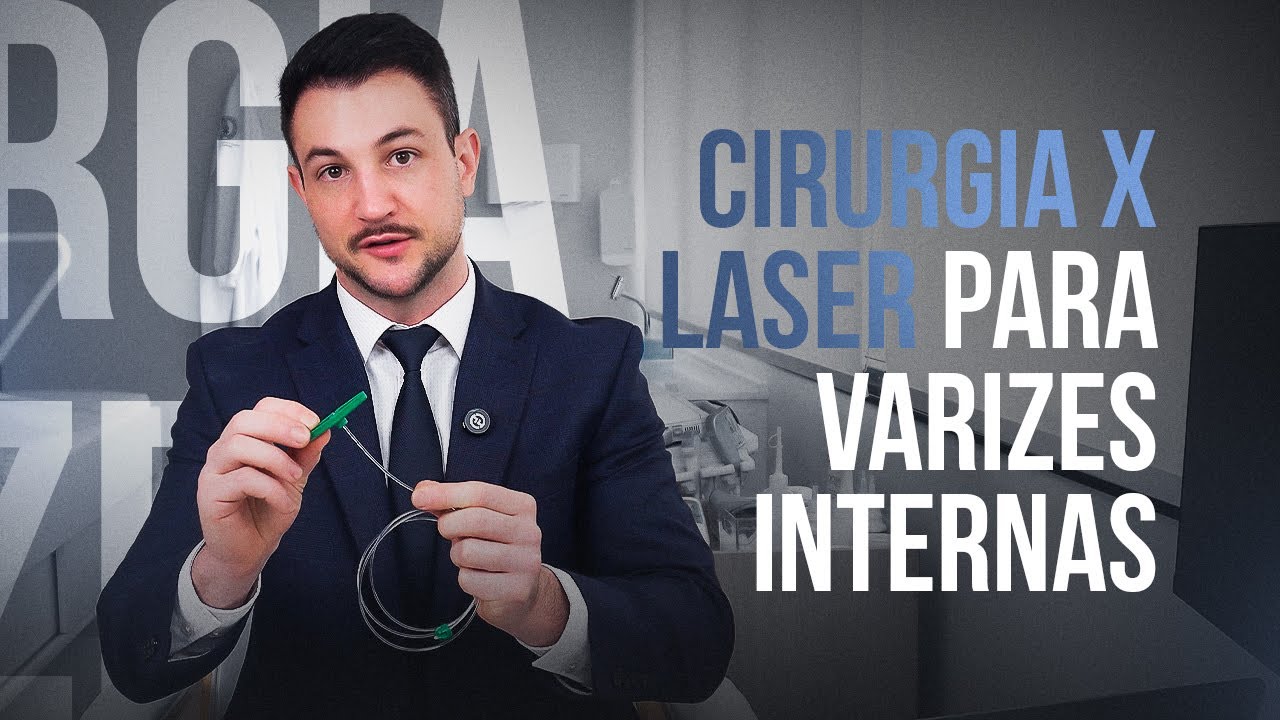 CIRURGIA x LASER - VARIZES INTERNAS E REFLUXOS DE VEIA SAFENA (SAFENECTOMIA x ABLAÇÃO À LASER)