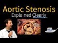 Aortic Stenosis Explained Clearly - Diagnosis and Treatment