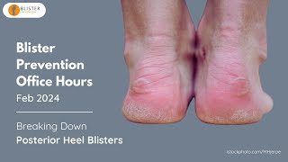 Blister Prevention Office Hours - Breaking Down Posterior Heel Blisters