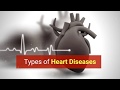 Different types of heart diseases  cpr select