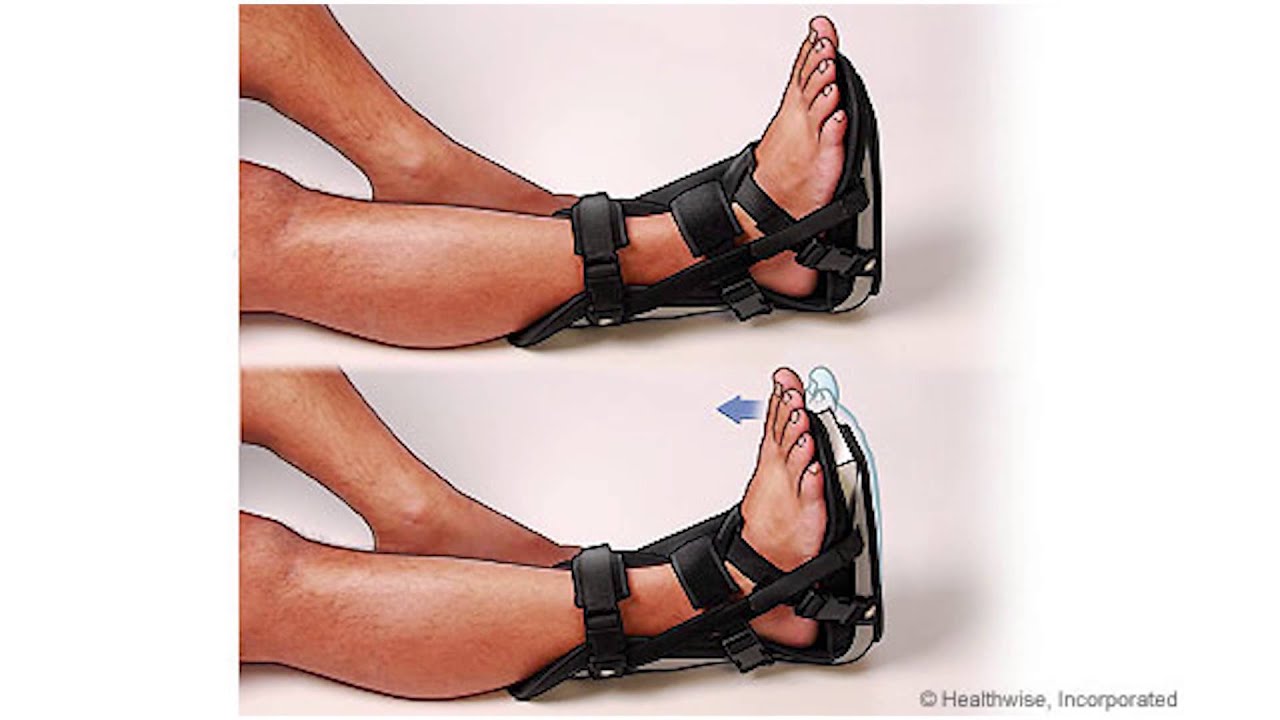 Ankle Sprains - American Foot and Leg Specialists podiatrist near me