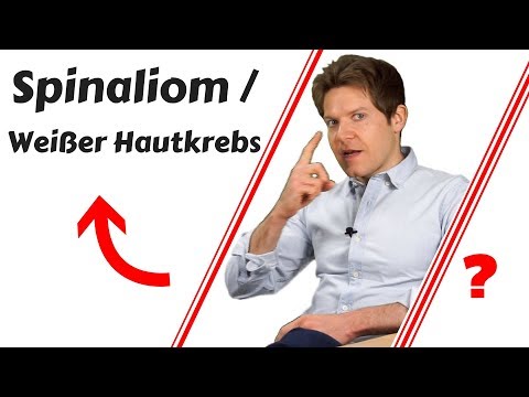 Video: Unterschied Zwischen Basalzelle Und Plattenepithelkarzinom