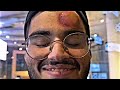 المصور الذي أصابه رونالدو امس🔞😰💔