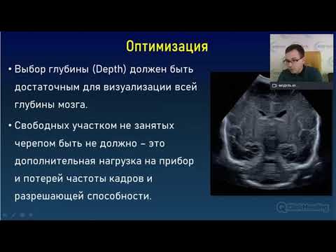 «Оптимизация изображения и возможности визуализации мозжечка  Оценка кровоизлияний в мозжечок»