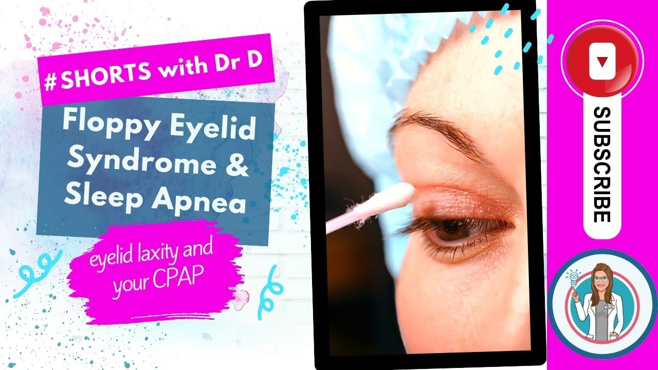 Are Your Floppy Eyelids A Symptom Of Sleep Apnea?