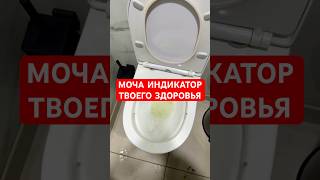Топ 5 причин почему твои почки не функционируют