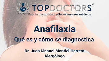 ¿Cuáles son los 3 criterios de la anafilaxia?