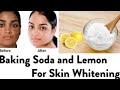 Skin whitening with Baking Soda|| Best Glowing Skin Tricks