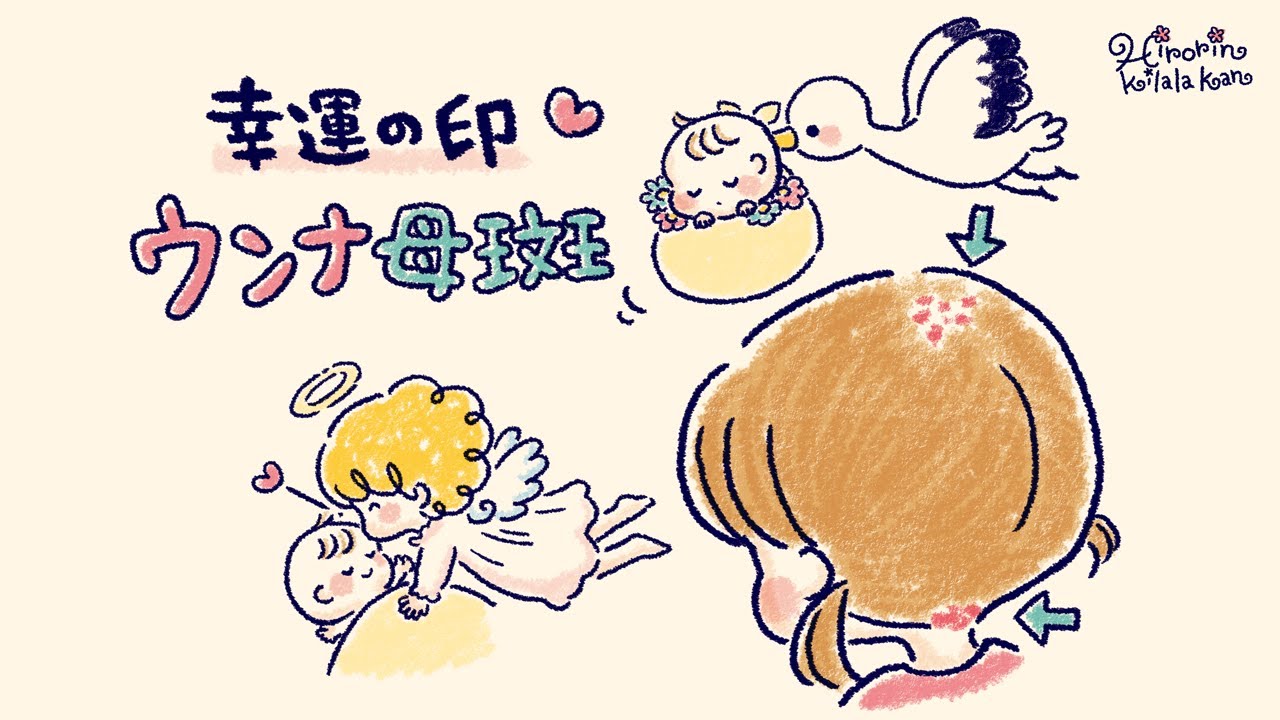 ウンナ母斑は幸運の印 赤ちゃんの首筋と後頭部の赤い痣には素敵な言い伝えがありました Youtube