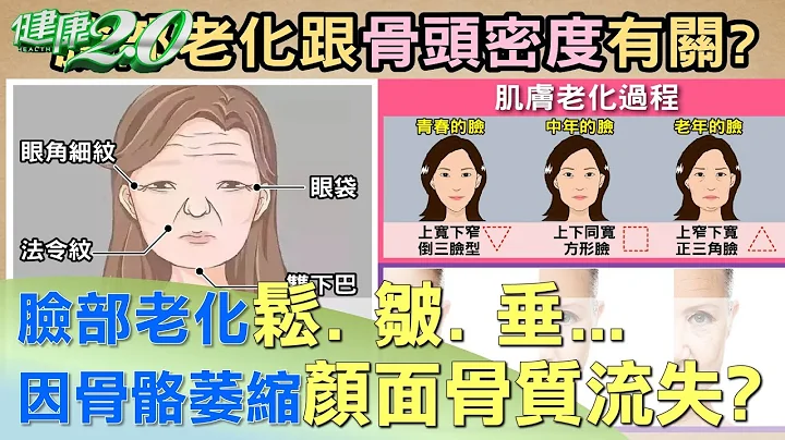 臉部老化鬆. 皺. 垂... 竟是骨骼萎縮顏面骨質流失? 健康2.0 - 天天要聞