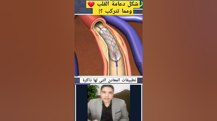 دعامة القلب ❤ تعرف بتتكون من ايه ؟! #قلب  #تكنولوجيا # shorts #short