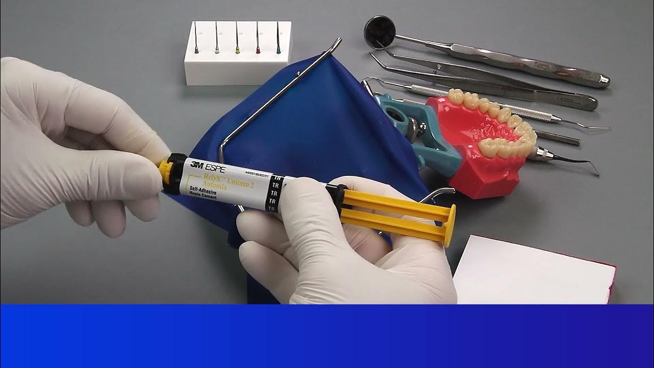 Posterior 3M™ RelyX™ Fiber Post Cementation with 3M™ RelyX™ Unicem 2 Automix SelfAdhesive Resin