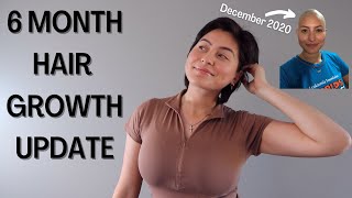 My hair has grown SO MUCH! | 6 MONTHS POST HEAD SHAVE