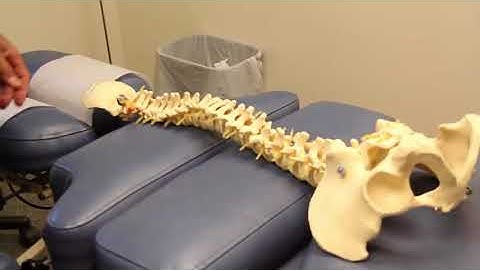 Scoliosis Treatment   Ames Chiropractic Wellness Center   Bangor, Corinna, Lincoln Maine