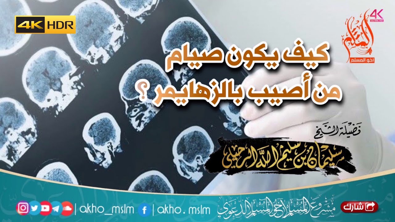 هل على من أصيب بمرض الزهايمر صوم ؟ -  الشيخ سليمان الرحيلي