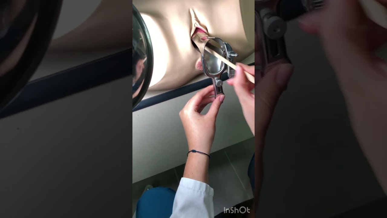 Toma de Citología Cervical - Andrea Uclés