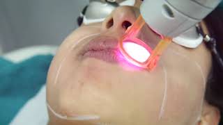 Laser hair removal for face screenshot 4