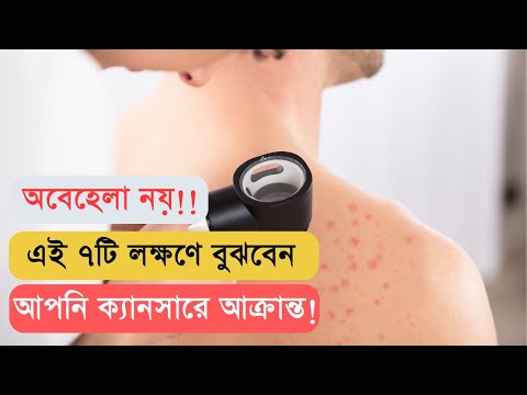 ক্যান্সারের যে ৭টি পূর্বলক্ষণ অধিকাংশ মানুষই অবহেলা করে বিপদে পড়ে যায়!!