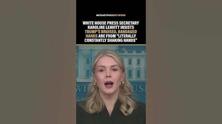 Trump Press Sec Makes LAUGHABLE EXCUSE for Trump HEALTH ISSUES