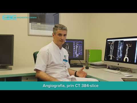 Video: Klinische Validatie En Beoordeling Van Aortische Hemodynamica Met Behulp Van Computationele Vloeistofdynamica Simulaties Van Computertomografie Angiografie