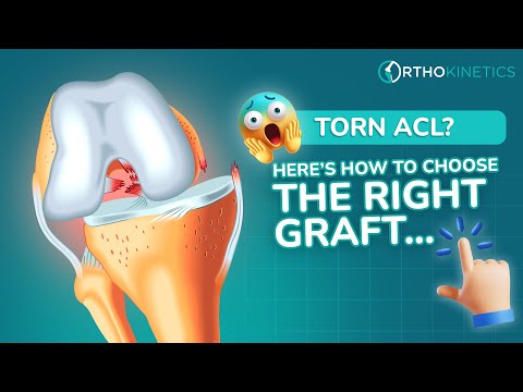 Video: Graft choices in ACL reconstruction