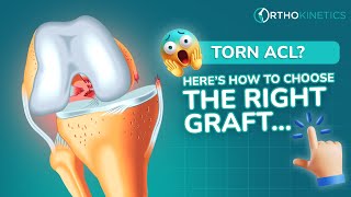 Graft Choices in ACL Reconstruction | Specialist Dr Sean Leo Explains