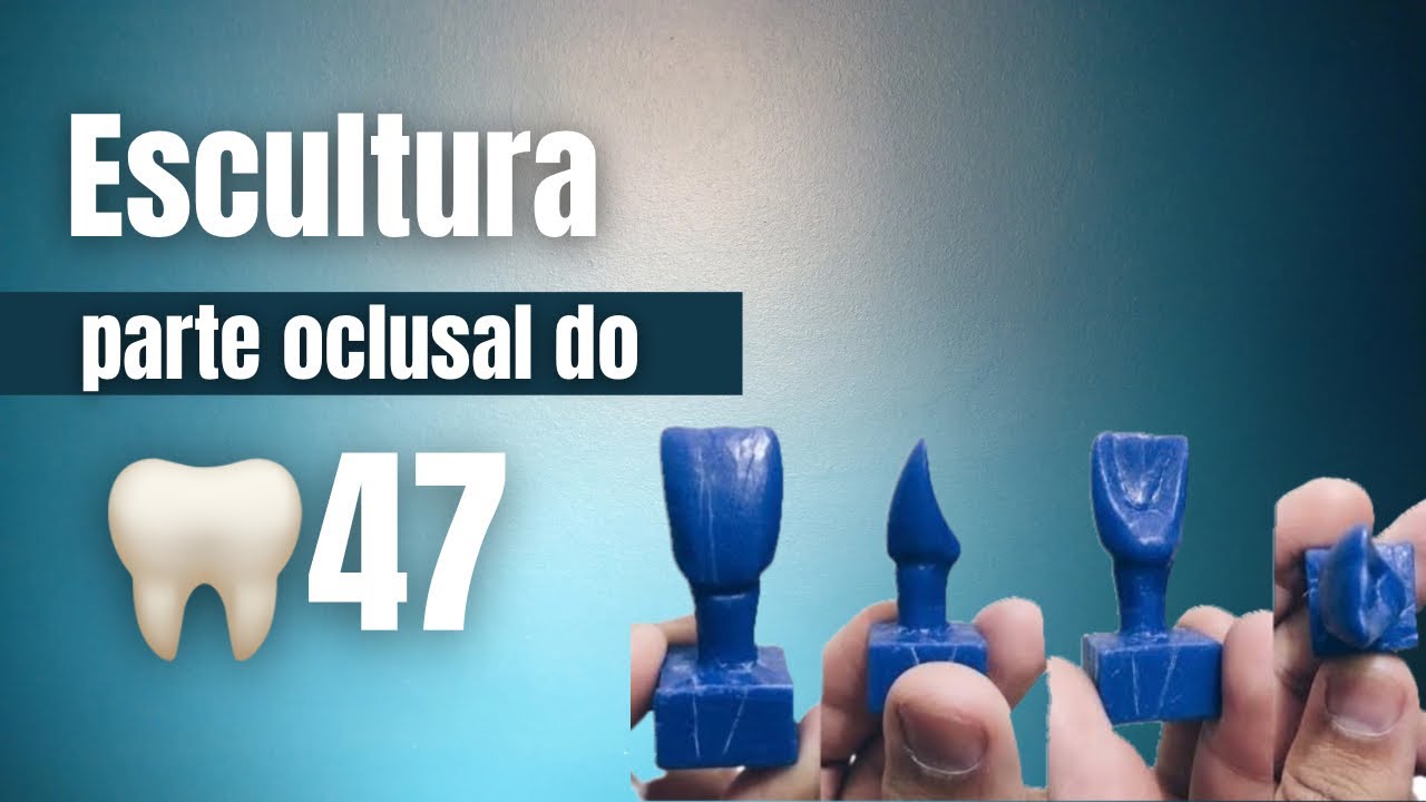 Escultura da parte oclusal do dente 47