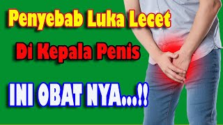 Penyebab Luka Lecet Di Kelamin Pria Dan Cara Mengobatinya