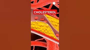 "What Is Cholesterol? Good vs Bad Cholesterol Explained in 60 Seconds!" #Shorts