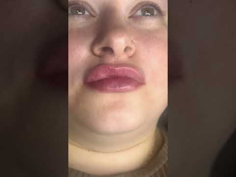 Посмотри на себя в новом образе -сделай губы этим летом . 🌹 #косметологростов