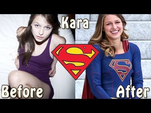 Supergirl ★ Before And After