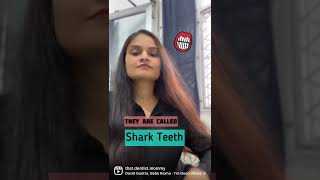 Does your is has Shark teeth? #sharkteeth #kidsteeth #shorts #youtubeindia #ashortaday #dentalcare
