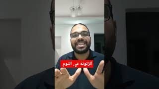 اسباب فوائد الثوم