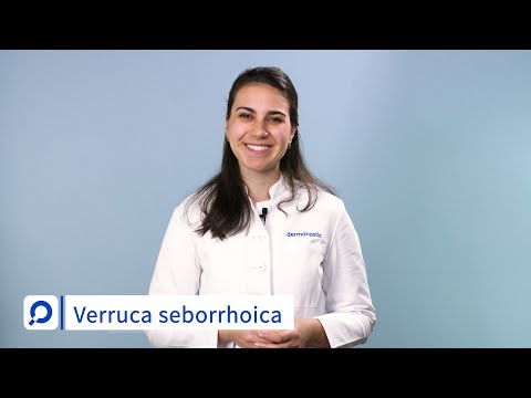 Video: Seborrhoische Alopezie - Ursachen, Symptome Und Behandlung