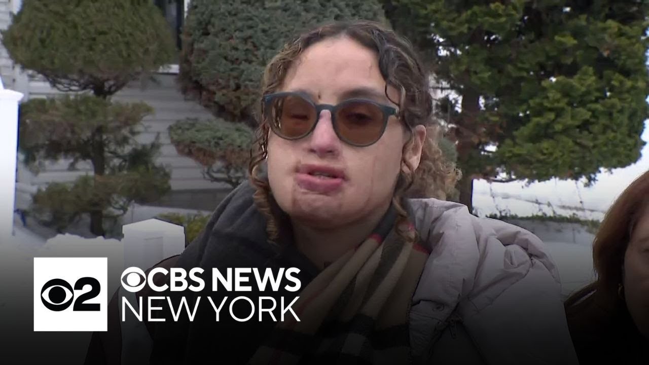 Arrest made in brutal 2021 acid attack on Long Island