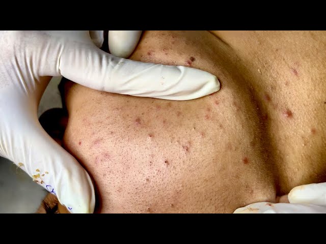 Satisfying video with Chung Vo Spa | 234