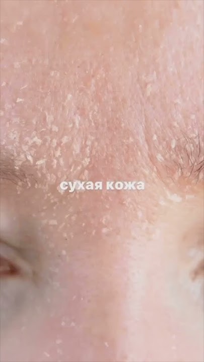 Уход за кожей (сальные нити, сухость, расширенные поры) - YouTube