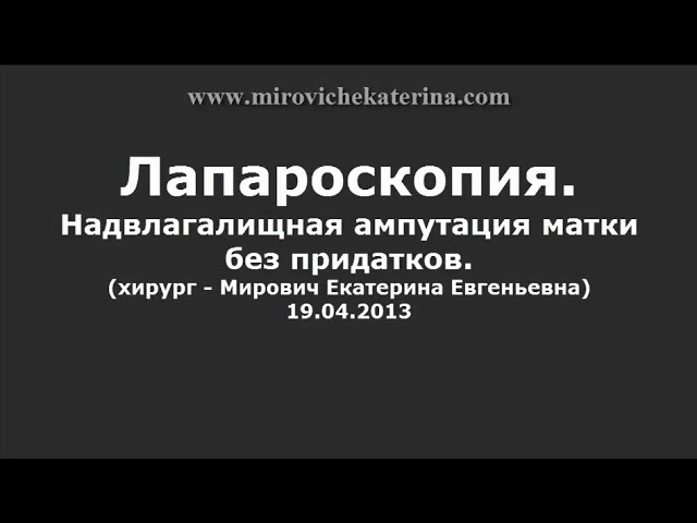 Надвлагалищная ампутация матки без придатков(Supravaginal amputation of uterus without adnexa)