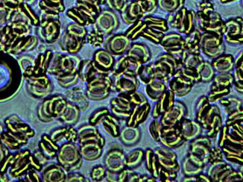 Blood Cells 10x Magnification - YouTube Blood Cells 10x Magnification - YouTube