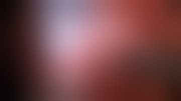 Laparoscopic Cholecystectomy - Dr.Abdul Kader Weiss