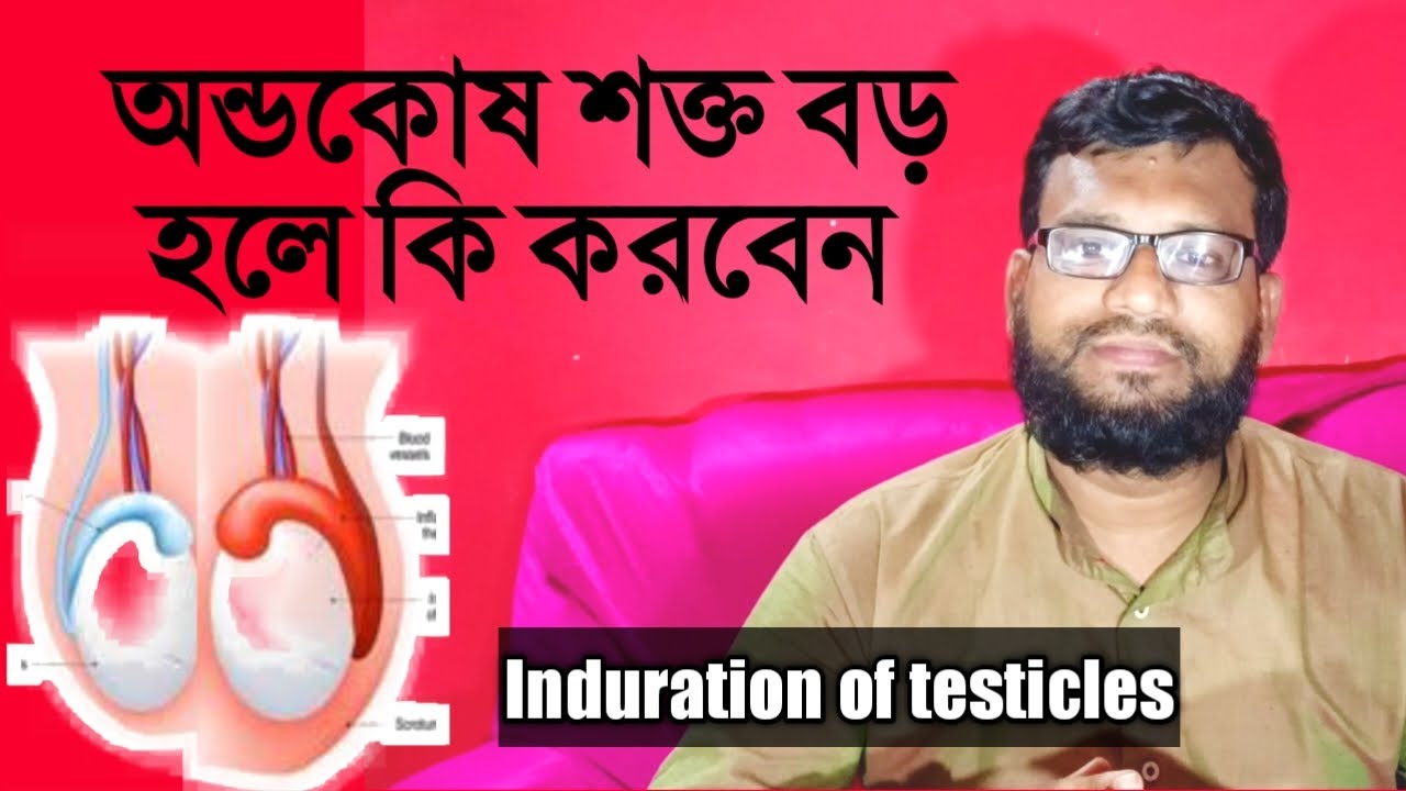 অন্ডকোষ শক্ত হওয়া বড় হওয়ার কারণ ও তার চিকিৎসা | Induration of testicles