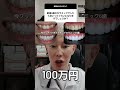 約100万円です。前歯6歯は1番人気の今クリアートダイヤモンドセラミックのモニター総額です。歯や歯ぐきの状態によりお費用前後いたします#セラミック #セラミック矯正#ダイヤモンド今井