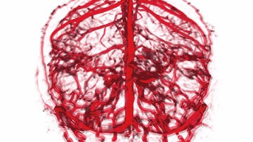 Perceptual Cues for Blood Vessel Visualization