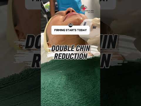 HIFU double chin reduction NOV 2025